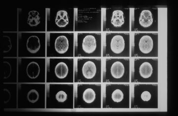 Photo ct scan